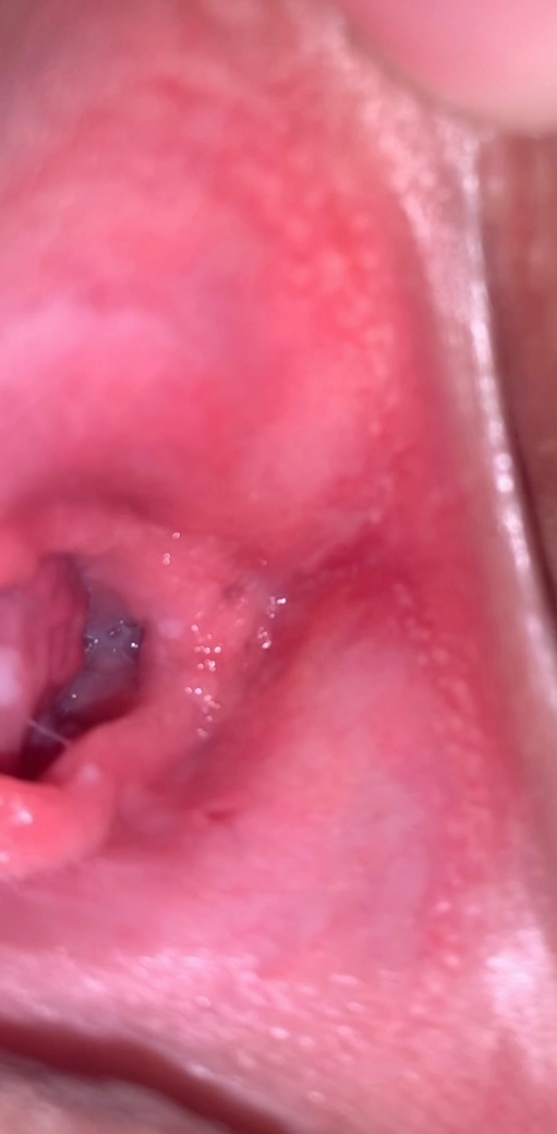 Cấu tạo màng trinh và các đặc điểm liên quan